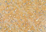 CDCA3 Antibody in Immunohistochemistry (Paraffin) (IHC (P))