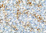 CDCA3 Antibody in Immunohistochemistry (Paraffin) (IHC (P))