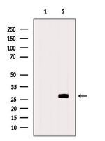 CDCA3 Antibody in Western Blot (WB)