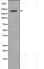 COL11A1 Polyclonal Antibody