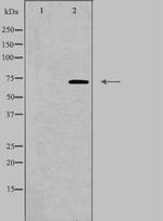COL13A1 Antibody in Western Blot (WB)