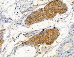COL20A1 Antibody in Immunohistochemistry (Paraffin) (IHC (P))