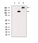 COL20A1 Antibody in Western Blot (WB)