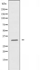 COX11 Polyclonal Antibody