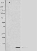 COX17 Polyclonal Antibody
