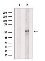 CYP21A2 Antibody in Western Blot (WB)