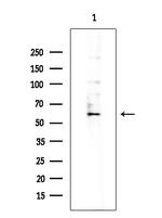 CYP27A1 Antibody in Western Blot (WB)