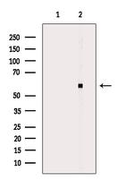 CYP2W1 Polyclonal Antibody