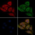 CYP3A43 Polyclonal Antibody