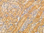 CYP4X1 Polyclonal Antibody