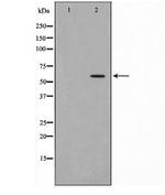 CYP4Z1 Polyclonal Antibody