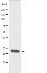 CIDEB Antibody in Western Blot (WB)