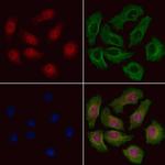 DATF1 Polyclonal Antibody