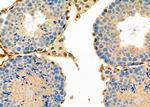 DATF1 Antibody in Immunohistochemistry (Paraffin) (IHC (P))