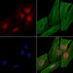 RAD54L Polyclonal Antibody