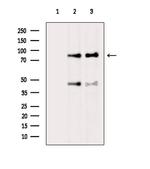 RAD54L Antibody in Western Blot (WB)