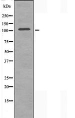 ORC1 Polyclonal Antibody