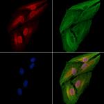 EFTUD2 Antibody in Immunocytochemistry (ICC/IF)