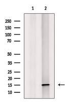MRPS16 Polyclonal Antibody