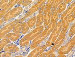 MRPL16 Polyclonal Antibody