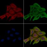 MRPL22 Polyclonal Antibody