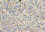 MRPL35 Antibody in Immunohistochemistry (Paraffin) (IHC (P))