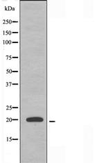 MRPL51 Antibody in Western Blot (WB)