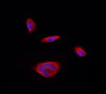 RPS12 Antibody in Immunocytochemistry (ICC/IF)