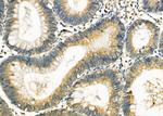 RPS12 Antibody in Immunohistochemistry (Paraffin) (IHC (P))
