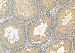 RPS12 Antibody in Immunohistochemistry (Paraffin) (IHC (P))