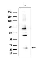RPS15 Polyclonal Antibody