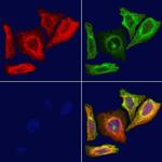 RPS20 Antibody in Immunocytochemistry (ICC/IF)