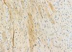 RPS20 Antibody in Immunohistochemistry (Paraffin) (IHC (P))