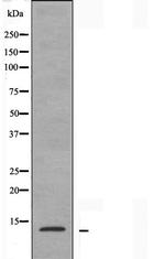 RPS20 Antibody in Western Blot (WB)