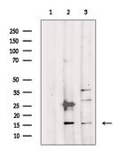 RPS23 Polyclonal Antibody