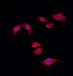 RPS4Y1 Polyclonal Antibody