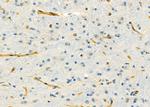 RPS5 Antibody in Immunohistochemistry (Paraffin) (IHC (P))