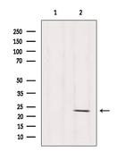 RPS5 Antibody in Western Blot (WB)