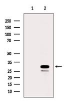 RPS8 Polyclonal Antibody