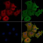 AZI1 Polyclonal Antibody