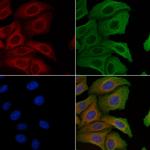 RPL10A Polyclonal Antibody