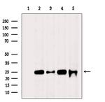 RPL10A Antibody in Western Blot (WB)