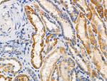 RPL10L Polyclonal Antibody