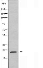 RPL12 Polyclonal Antibody