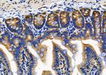 RPL18 Polyclonal Antibody