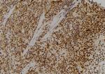 RPL23 Polyclonal Antibody