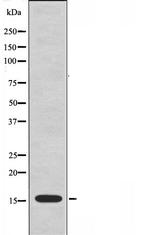 RPL23 Antibody in Western Blot (WB)