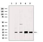 RPL26L1 Antibody in Western Blot (WB)