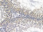 RPL7 Antibody in Immunohistochemistry (Paraffin) (IHC (P))