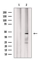 ABHD12 Polyclonal Antibody